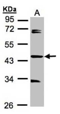 Western Blot: SDCCAG3 Antibody [NBP1-31567]