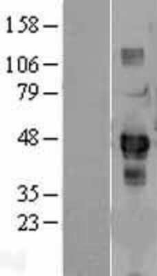 Western Blot: SDCCAG3 Overexpression Lysate [NBL1-15763]