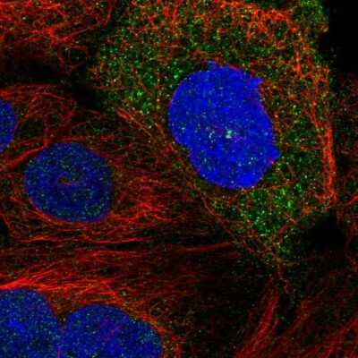 Immunocytochemistry/ Immunofluorescence: SDCCAG8 Antibody [NBP2-55249]