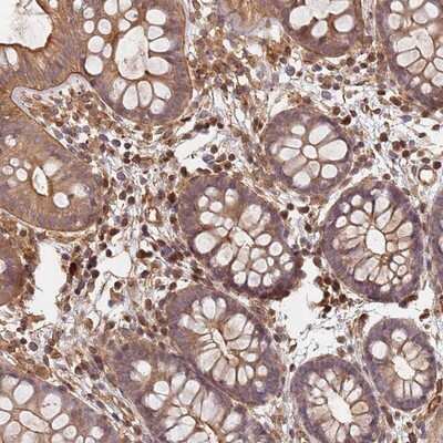 Immunohistochemistry-Paraffin: SDCCAG8 Antibody [NBP2-13288]