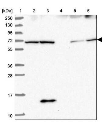 Western Blot: SDCCAG8 Antibody [NBP2-13288]