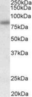 Western Blot: SDCCAG8 Antibody [NBP2-27499]