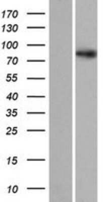 Western Blot: SDCCAG8 Overexpression Lysate [NBP2-07598]