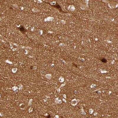 Immunohistochemistry-Paraffin: SDCG1 Antibody [NBP1-87924]