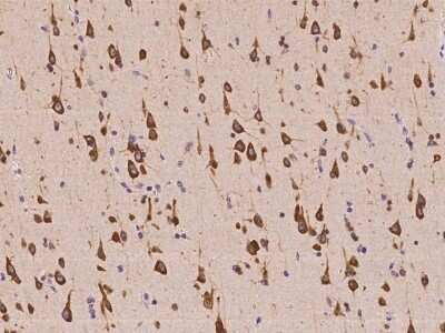 Immunohistochemistry-Paraffin: SDCG1 Antibody [NBP2-98083]