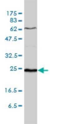 Western Blot: SDF2 Antibody (3G7-1D6) [H00006388-M01]