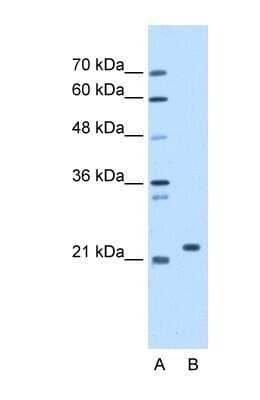 Western Blot: SDF2 Antibody [NBP1-58376]