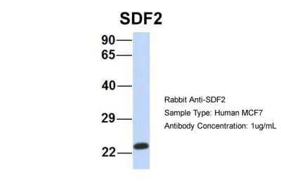 Western Blot: SDF2 Antibody [NBP2-86793]