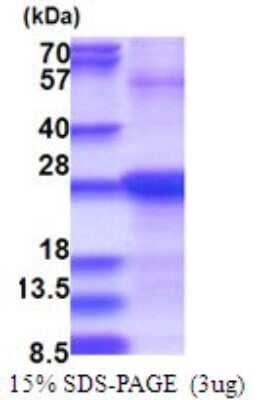 SDS-PAGE: Recombinant Human SDF2 His Protein [NBP2-51718]