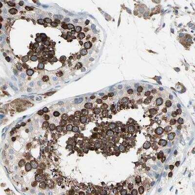 Immunohistochemistry-Paraffin: SDF2L1 Antibody [NBP1-90854]