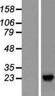 Western Blot: SDF2L1 Overexpression Lysate [NBP2-06484]