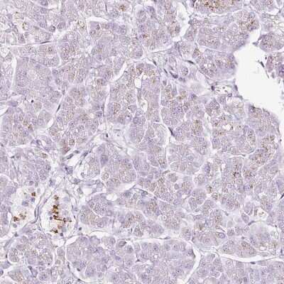 Immunohistochemistry-Paraffin: SDF4 Antibody [NBP2-47284]