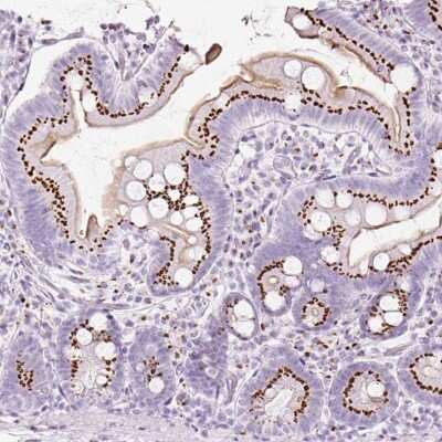 Immunohistochemistry-Paraffin: SDF4 Antibody [NBP2-47284]