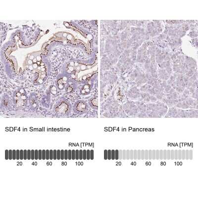 Immunohistochemistry-Paraffin: SDF4 Antibody [NBP2-47284]