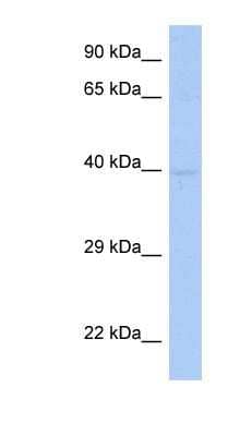 Western Blot: SDF4 Antibody [NBP1-62577]