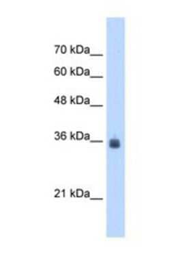 Western Blot: SDF4 Antibody [NBP1-69311]