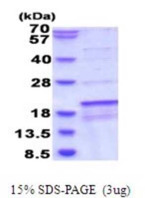 SDS-PAGE: Recombinant Human SDH Assembly Factor 1 His Protein [NBP2-51888]