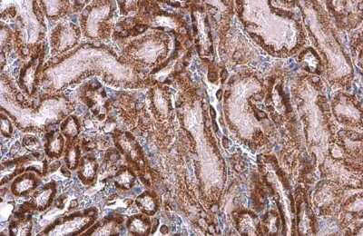 Immunohistochemistry-Paraffin: SDHA Antibody (GT20710) [NBP3-13522]