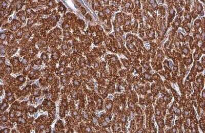 Immunohistochemistry-Paraffin: SDHA Antibody (GT20710) [NBP3-13522]