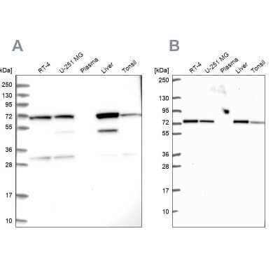 Western Blot: SDHA Antibody [NBP2-32594]