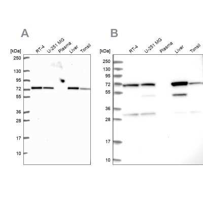 Western Blot: SDHA Antibody [NBP2-56988]