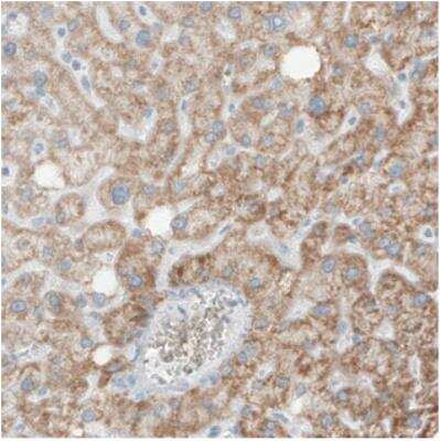 Immunohistochemistry: SDHB Antibody (CL0346) [NBP2-30677]