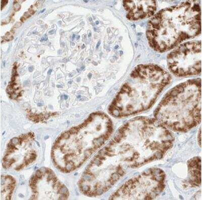 Immunohistochemistry: SDHB Antibody (CL0346) [NBP2-30677]