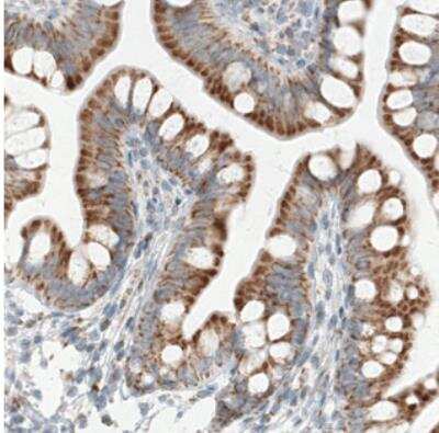 Immunohistochemistry: SDHB Antibody (CL0346) [NBP2-30677]