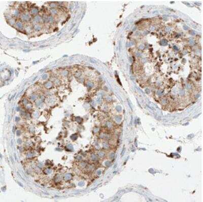 Immunohistochemistry: SDHB Antibody (CL0346) [NBP2-30677]