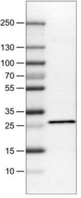 Western Blot: SDHB Antibody (CL0346) [NBP2-30677]