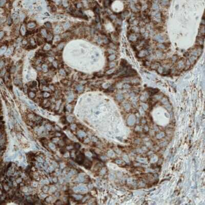 Immunohistochemistry: SDHB Antibody (CL0347) [NBP2-52920]