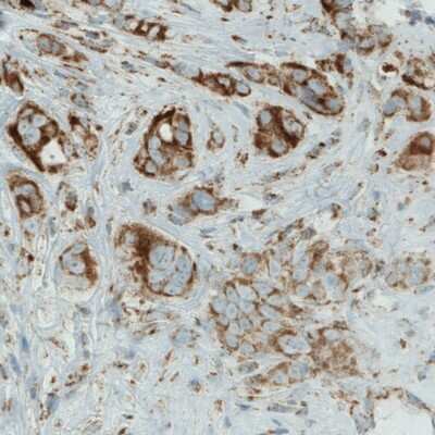 Immunohistochemistry-Paraffin: SDHB Antibody (CL0347) [NBP2-52920]