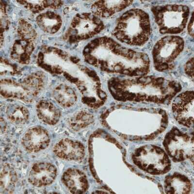 Immunohistochemistry-Paraffin: SDHB Antibody (CL0347) [NBP2-52920]