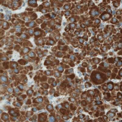 Immunohistochemistry-Paraffin: SDHB Antibody (CL0347) [NBP2-52920]