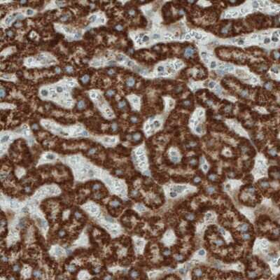 Immunohistochemistry-Paraffin: SDHB Antibody (CL0347) [NBP2-52920]