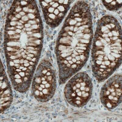 Immunohistochemistry-Paraffin: SDHB Antibody (CL0347) [NBP2-52920]