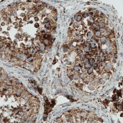 Immunohistochemistry-Paraffin: SDHB Antibody (CL0347) [NBP2-52920]