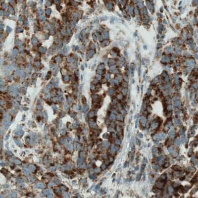 Immunohistochemistry-Paraffin: SDHB Antibody (CL0347) [NBP2-52920]
