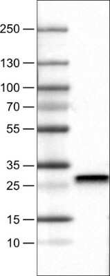 Western Blot: SDHB Antibody (CL0347) [NBP2-52920]