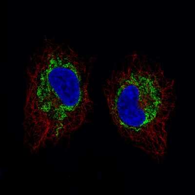 Immunocytochemistry/ Immunofluorescence: SDHB Antibody (CL0349) [NBP2-52921]