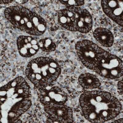 Immunohistochemistry-Paraffin: SDHB Antibody (CL0349) [NBP2-52921]