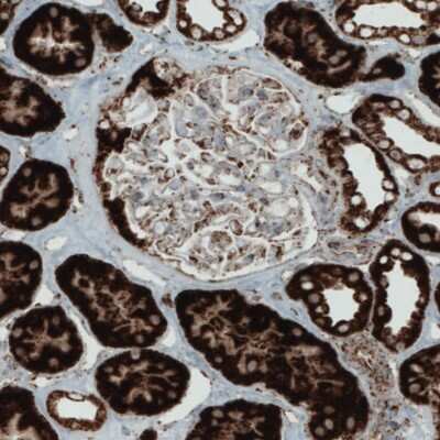 Immunohistochemistry-Paraffin: SDHB Antibody (CL0349) [NBP2-52921]