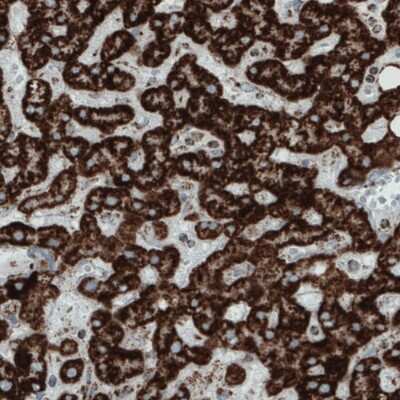 Immunohistochemistry-Paraffin: SDHB Antibody (CL0349) [NBP2-52921]