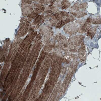 Immunohistochemistry-Paraffin: SDHB Antibody (CL0349) [NBP2-52921]