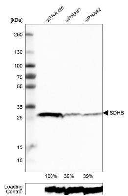 Western Blot: SDHB Antibody (CL0349) [NBP2-52921]