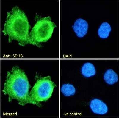 Immunocytochemistry/ Immunofluorescence: SDHB Antibody [NB600-793]