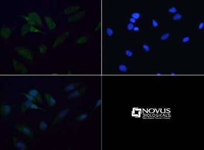 Immunocytochemistry/ Immunofluorescence: SDHB Antibody - BSA Free [NBP1-54154]