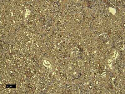 Immunohistochemistry: SDHB Antibody [NB600-793]