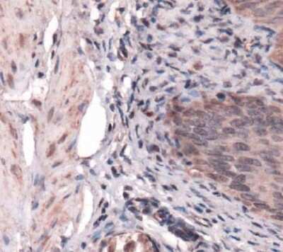 Immunohistochemistry: SDHB Antibody - BSA Free [NBP1-54154]