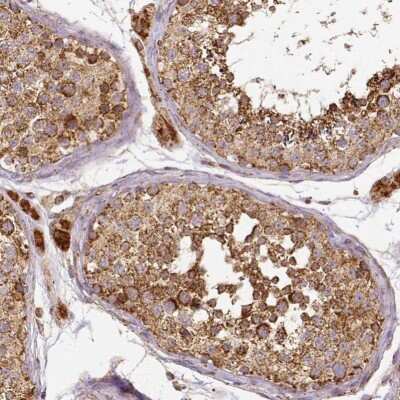 Immunohistochemistry-Paraffin: SDHB Antibody [NBP1-87069]